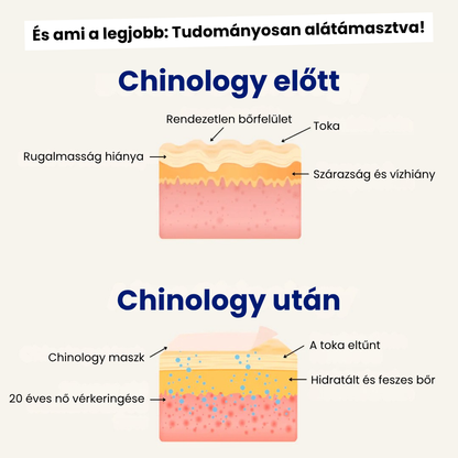 Chinology™ Áll Formáló Maszk