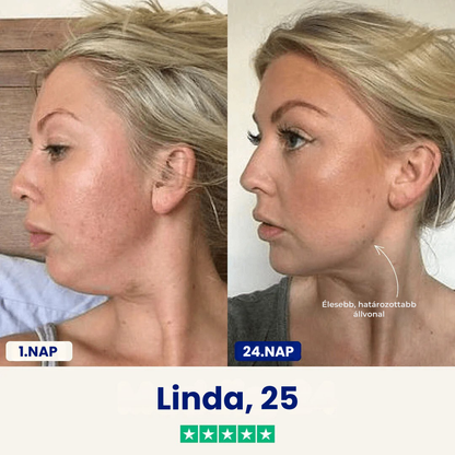 Chinology™ Áll Formáló Maszk