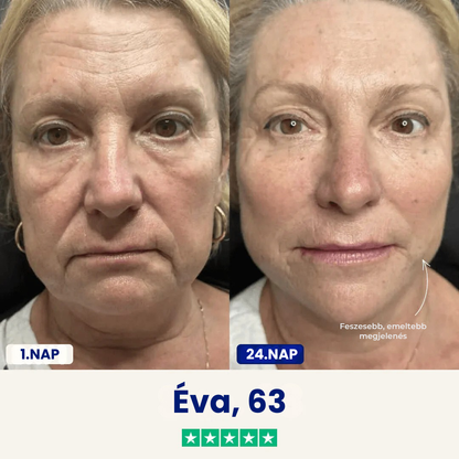 Chinology™ Áll Formáló Maszk